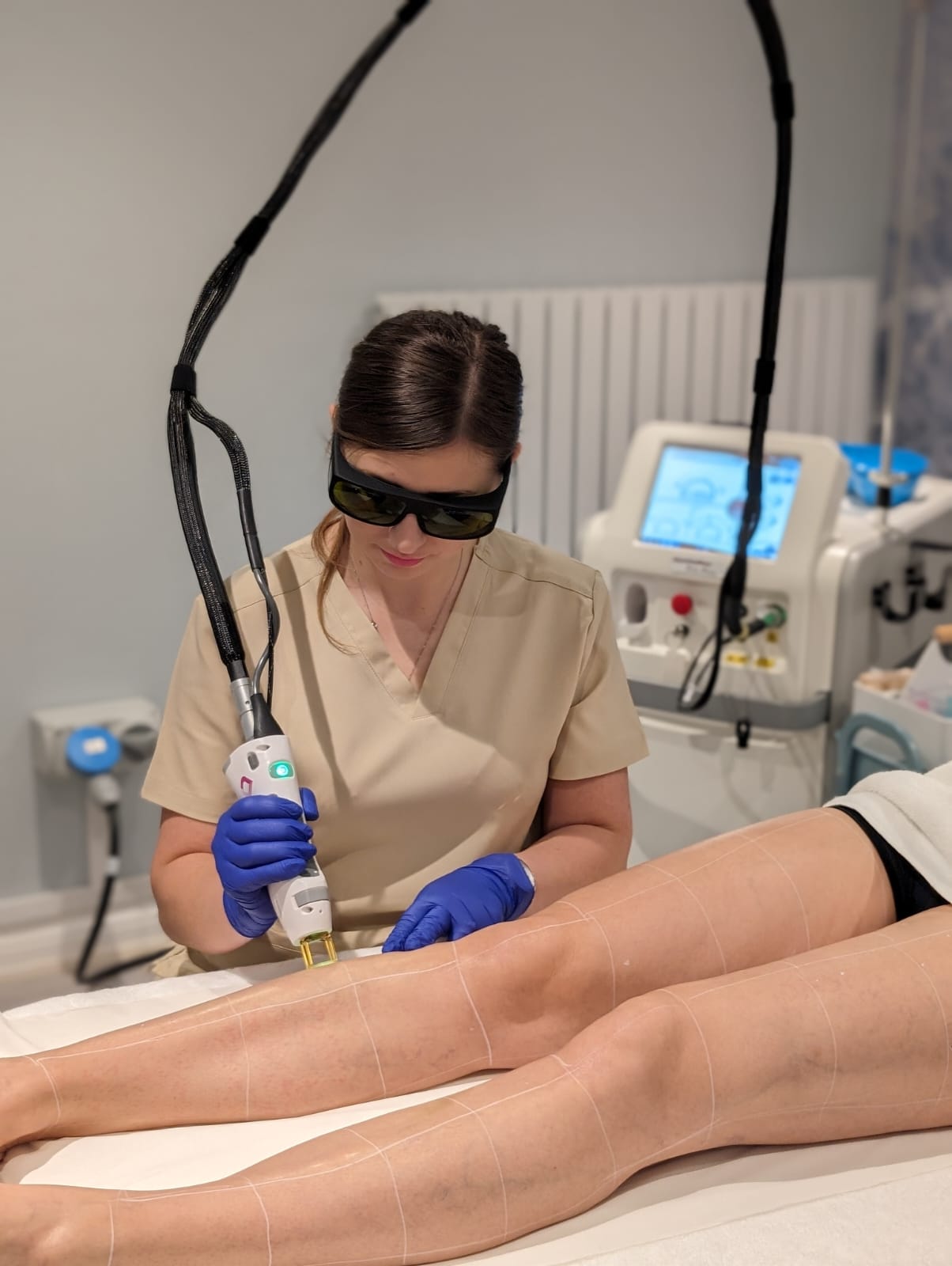Laser treatment with protective eyewear and a Candela handpiece at Progen Aesthetics