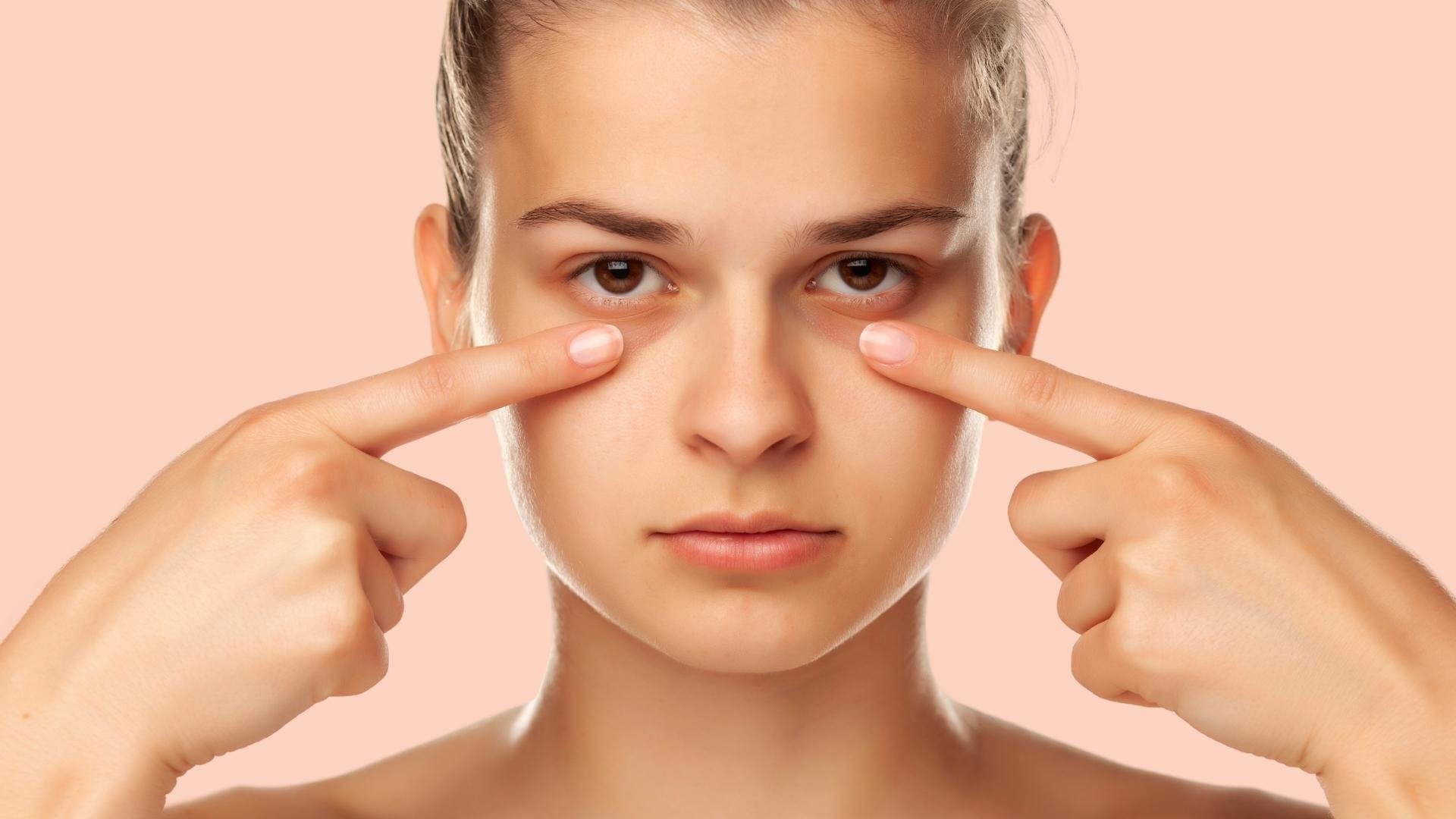 Illustrative photograph highlighting the under-eye area, retained from the original website