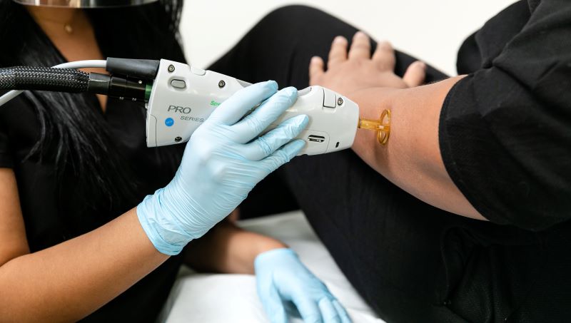 What is Candela Laser Hair Removal?